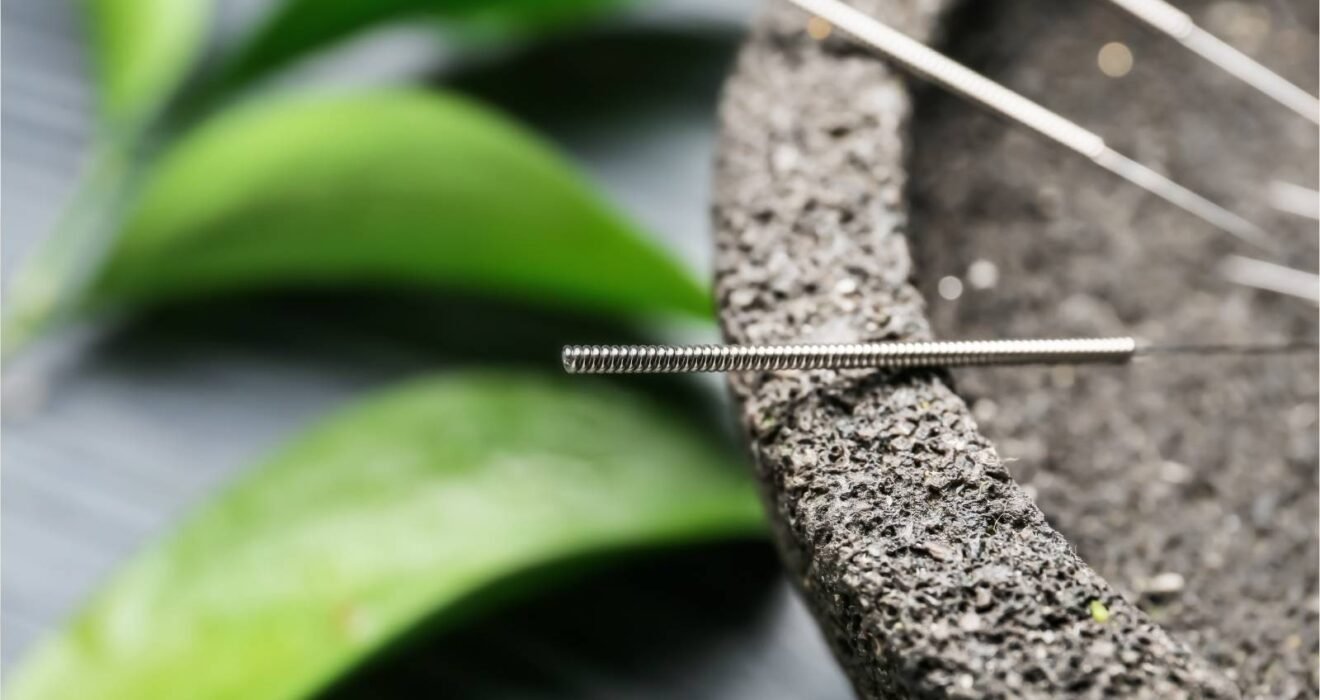 Aşırı aktif mesanede akupunkturun sıkışma ve idrara çıkma sıklığı gibi şikâyetlerde destekleyici bir yaklaşım olarak değerlendirildiğini gösteren temsili görsel