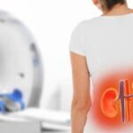 Böbrek taşını önlemek için 10 etkili öneri