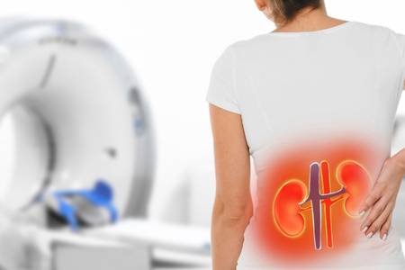 Böbrek taşını önlemek için 10 etkili öneri