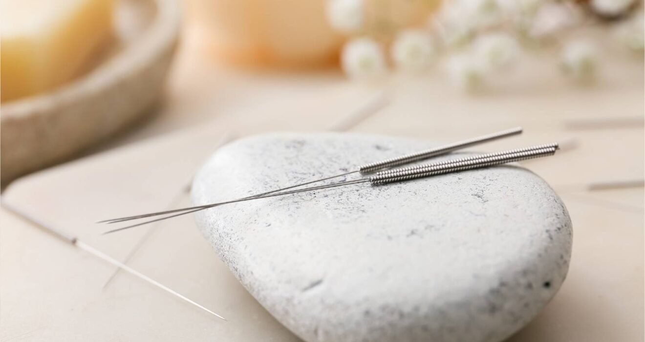 İyi huylu prostat büyümesinde akupunkturun şikâyet yönetiminde tamamlayıcı bir yaklaşım olarak değerlendirildiğini gösteren temsili görsel