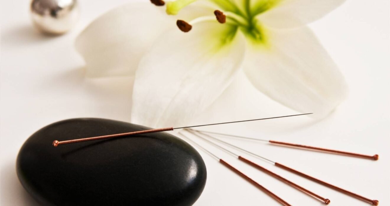 Kısırlık sürecinde akupunkturun kişiye özel, tamamlayıcı bir destek yaklaşımı olarak değerlendirildiğini gösteren temsili görsel