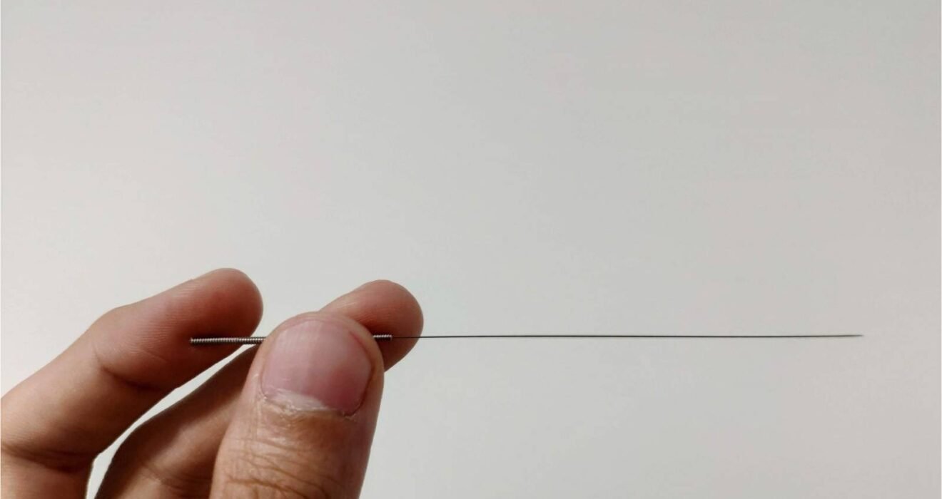 Ürolojide akupunktur uygulamasının destekleyici yaklaşım olarak değerlendirilmesini gösteren temsili görsel